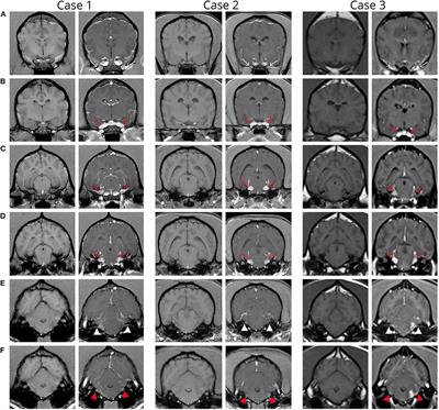 Case Report: Meningoencephalomyelitis of Unknown Etiology Manifesting as a Bilateral Cranial Polyneuropathy in 3 Dogs